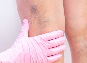 Angiologia Angiologia